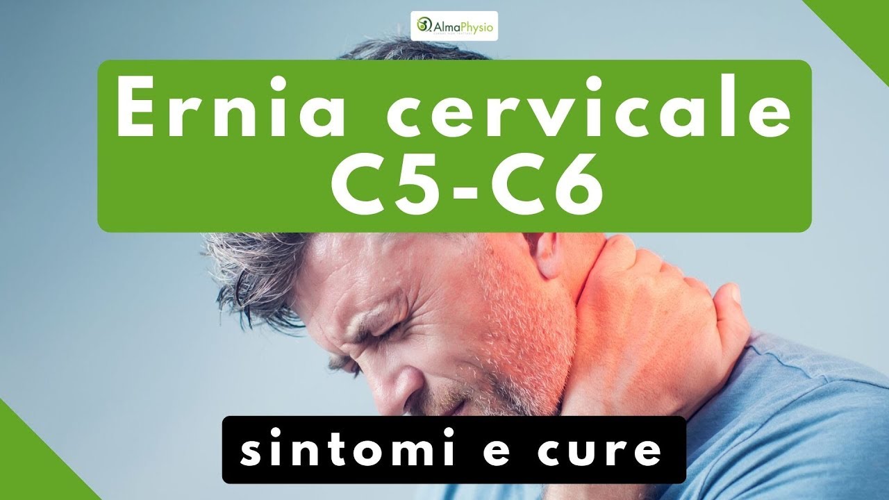 ernia cervicale C5 C6 sintomi e cure