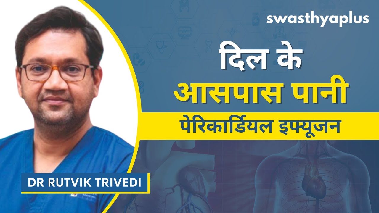 पेरिकार्डियल इफ्यूजन: लक्षण और उपचार | What is Pericardial Effusion? in Hindi 