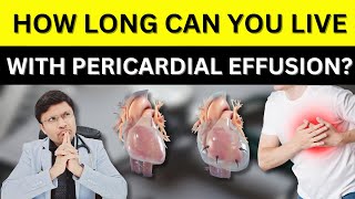 Pericardial Effusion: Causes, Symptoms, Diagnosis & Treatment #PERICARDIALEFFUSION