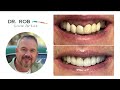 Dr. Rob Barrick Smile Portfolio 2024