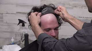 Men's Hair Replacement: The instant fix for bald or thinning men