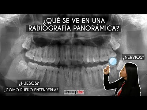 ¿Qué se ve en una radiografía panorámica? ¿Cómo puedo entenderla? 🦷 - Odontología Láser.