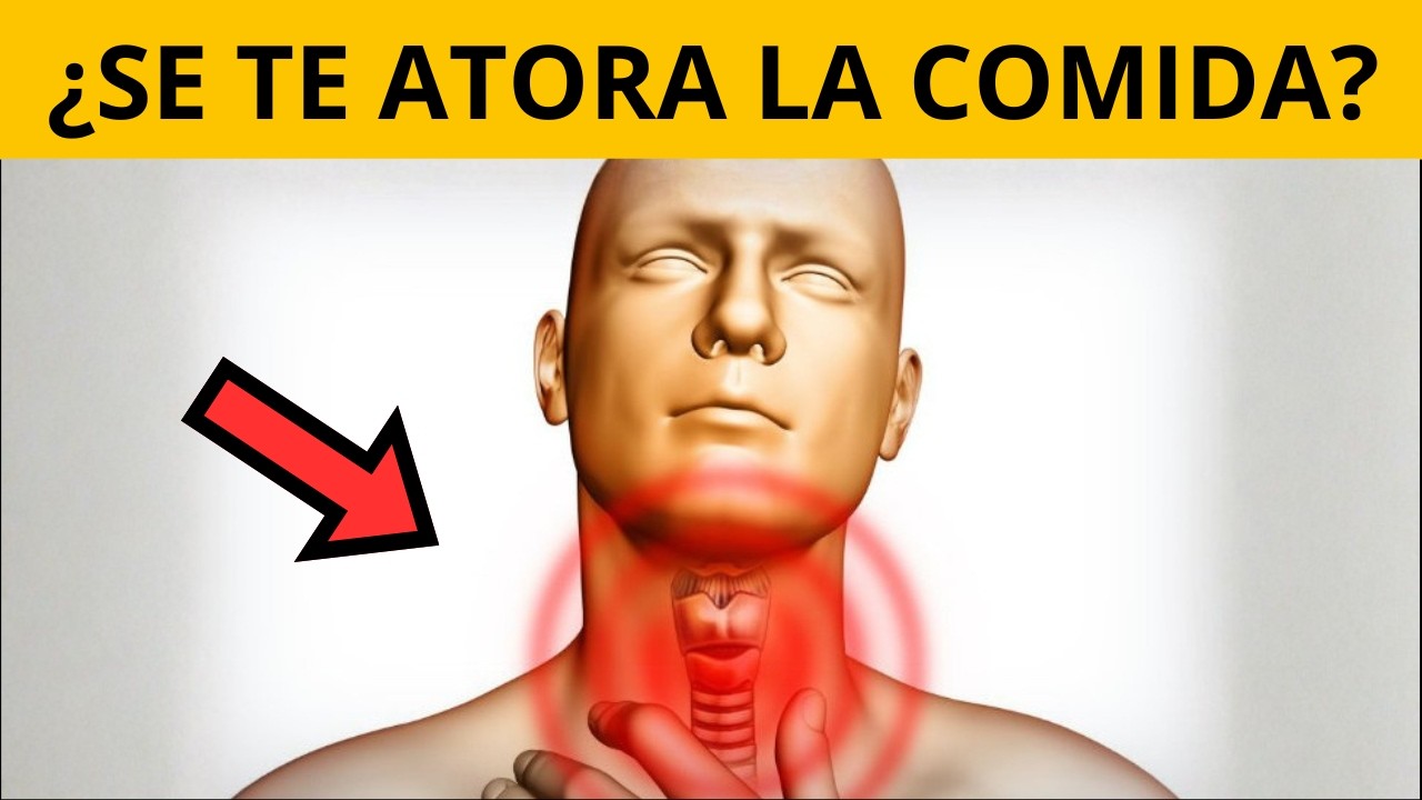 ¿Se te atora la comida? Podría ser DISFAGIA - Guía de nutrición
