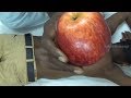 World S Createst Apple Back Pain Relief Massage CS ASMR