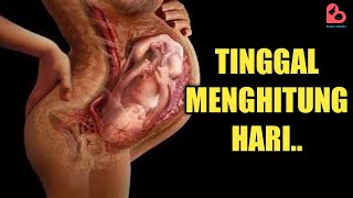 Download lagu TANDA PERSALINAN TINGGAL MENGHITUNG HARI mp3 Download lagu TANDA PERSALINAN TINGGAL MENGHITUNG HARI mp3