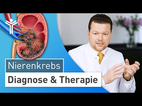 Wie gefährlich ist ein Nierentumor? Symptome und Behandlung von Nierenkrebs