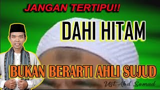 Download lagu Dahi Hitam atau Kening Hitam Belum Tentu Ahli Sujud, Bisa Jadi Karena Ini Kata Ustadz Abdul Somad mp3