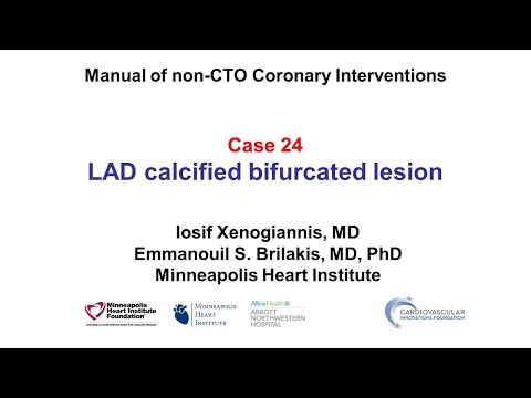 Case 24: PCI Manual: LAD calcified bifurcation lesion