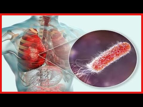 Bakterien in den Lungen? Was du darüber wissen solltest