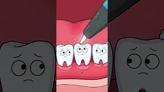 Finalmente fecharam o espaço entre os dentes dele