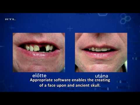 Most frequently occuring problems with our teeth in the 21th century