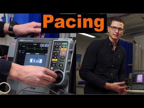 How to Perform Pacing Step by Step Guide for Paramedics and Healthcare Professionals