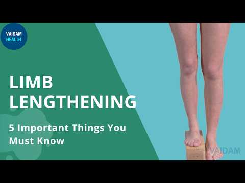 Limb Lengthening- 5 Important Things To Know