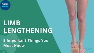 Limb Lengthening - 5 Important Things To Know