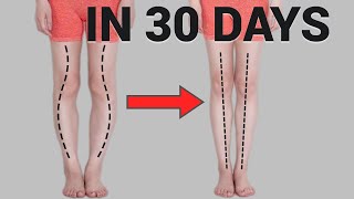 Get Straight Legs in 30 Days! Fix O or X-Shaped Legs (Knee Internal Rotation)