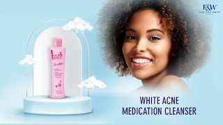 Fair & White So White Acne Medication Cleanser Lotion - 250ml