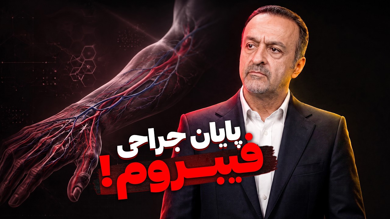 درمان جدید فیبروم رحم بدون جراحی و بیهوشی! / آمبولیزیشن فیبروم با آنژیوگرافی ?