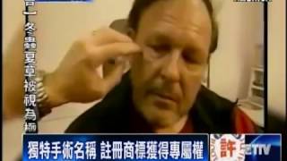 S2E5 知名整型醫師 獨創手術方法註冊商標   Cosmetic Surgeon Trademarks 360 Facelift® 11 21 14