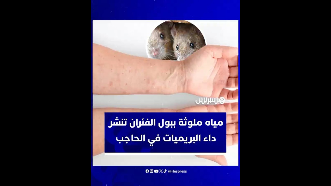 تحذيرات صحية في الحاجب.. مياه ملوثة ببول الفئران تنشر داء البريميات thumbnail