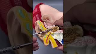 How To Clean Ear Wax Properly #shorts