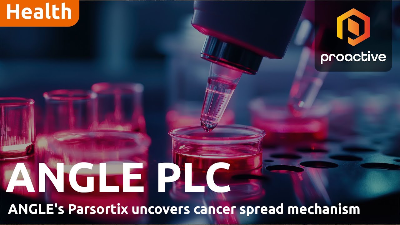 ANGLE says novel research highlights importance of Parsortix in cancer progression