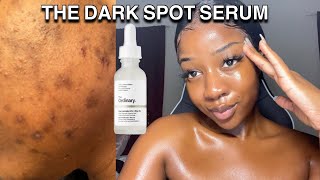 HOW TO GET RID OF DARK SPOTS WITH ONE PRODUCT | The ordinary