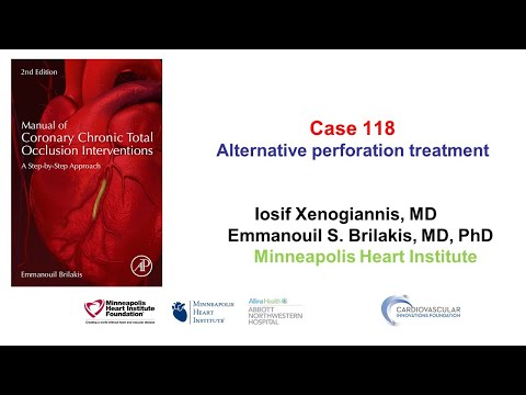 Case 118: Manual of CTO Interventions: Alternative treatment of large vessel perforation