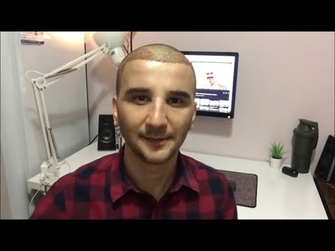 SAÇ EKİMİ ÖNCESİ VE SONRASI - KABUK DÖKME - YIKAMA 1.hafta 2.Hafta 3.ay 4.ay 6.ay VİDEO