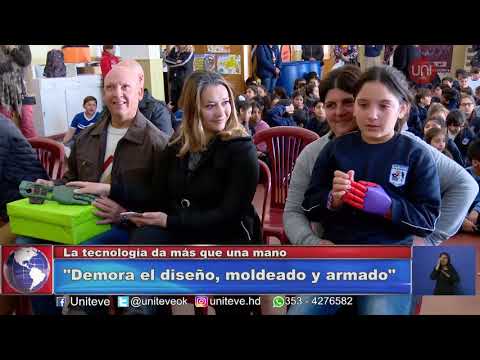 Entregaron manos ortopédicas