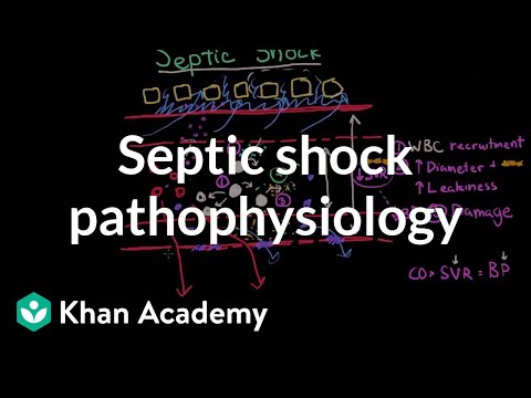 Septic shock - pathophysiology and symptoms | NCLEX-RN | Khan Academy Video