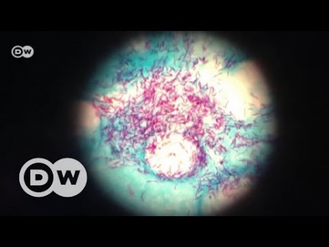 Tuberculosis in Ukraine | DW English