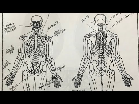 Giannas Autopsy