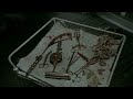 Cena Da Cirurgia Dublado Batman 1989
