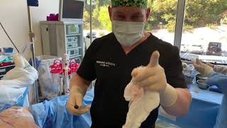 PLUMP THOSE LIPS! VAGINAL REJUVENATION WITH FAT AND STEM CELLS | West Hollywood, CA | Dr. Jason Emer video