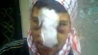 preview picture of video 'Siria, Homs, Testigo Masacre de Homs Herido de Bala por Milicias del Regimen, 18/04/2011'