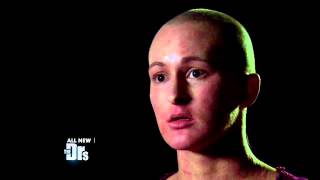 Womans Life Destroyed by Extreme Eczema