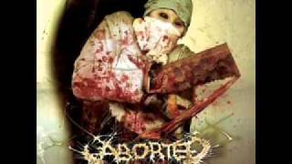 Meticulous Invagination - Aborted