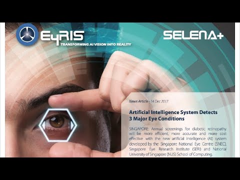 AI EyRIS SELENA+