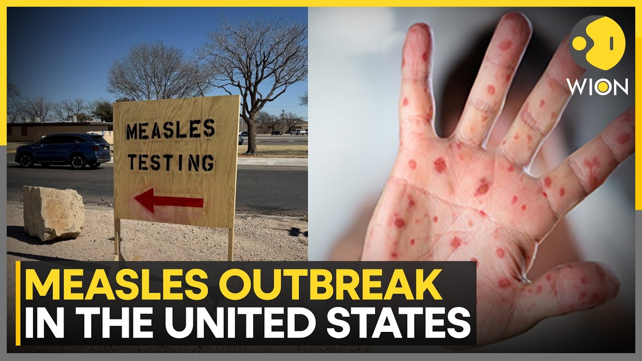 Measles Outbreak: Pennsylvania Grapples with Measles Outbreak | WION Health Matters