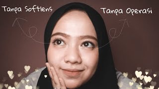 Download lagu Mata Besar Tanpa Softlens? Ini dia caranya dan tutorialnya mp3