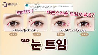 쌍커풀 수술과 어울리는 눈트임 추천 드립니다!