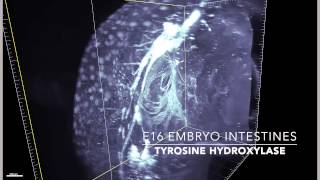 Download lagu iDISCO: Dopaminergic system in the embryonic mouse mp3 Download lagu iDISCO: Dopaminergic system in the embryonic mouse mp3