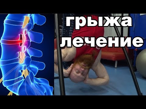 Инверсионный стол при грыже позвоночника: лечение