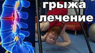 Грыжа позвоночника. Лечение 7 минут в день