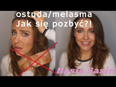 OSTUDA/MELASMA || Jak się pozbyć przebarwień?