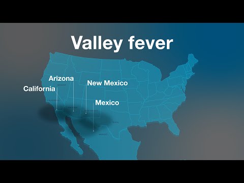 Mayo Clinic Minute - What is valley fever?
