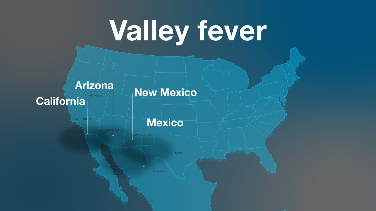 Mayo Clinic Minute - What is valley fever?