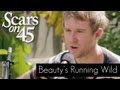 Scars on 45 - "Beauty's Running Wild" Live ...