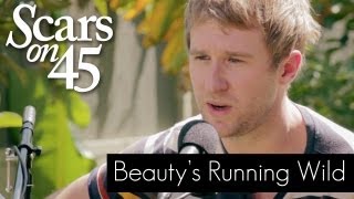 Scars on 45 - &quot;Beauty&#39;s Running Wild&quot; Live Acoustic Session
