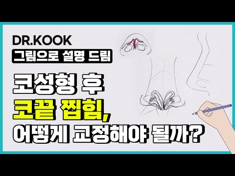 [그림설명] 코 성형 후 나타나는 코끝 찝힘, 어떻게 교정해야 될까?